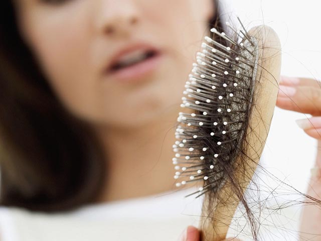 Is Dairy the Culprit Behind Your Hair Loss?