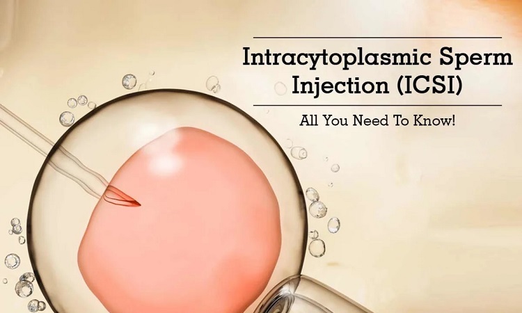 All you need to know about Intracytoplasmic Sperm Injections (ICSI)