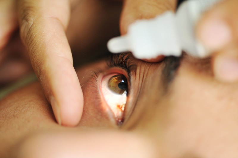 Eye Drop Elmiron May Cause Retinal Damage and Vision Loss