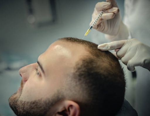 Here is Why Hair Transplants are an essential service