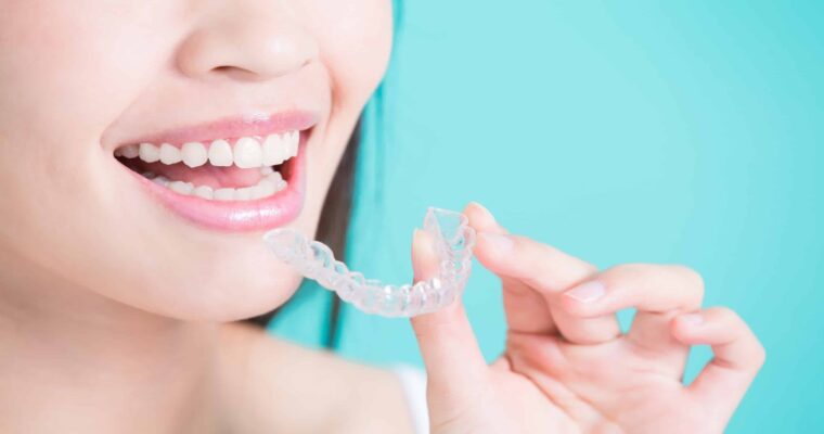 Aligners Treatment Planning In USA Is Becoming A Necessity