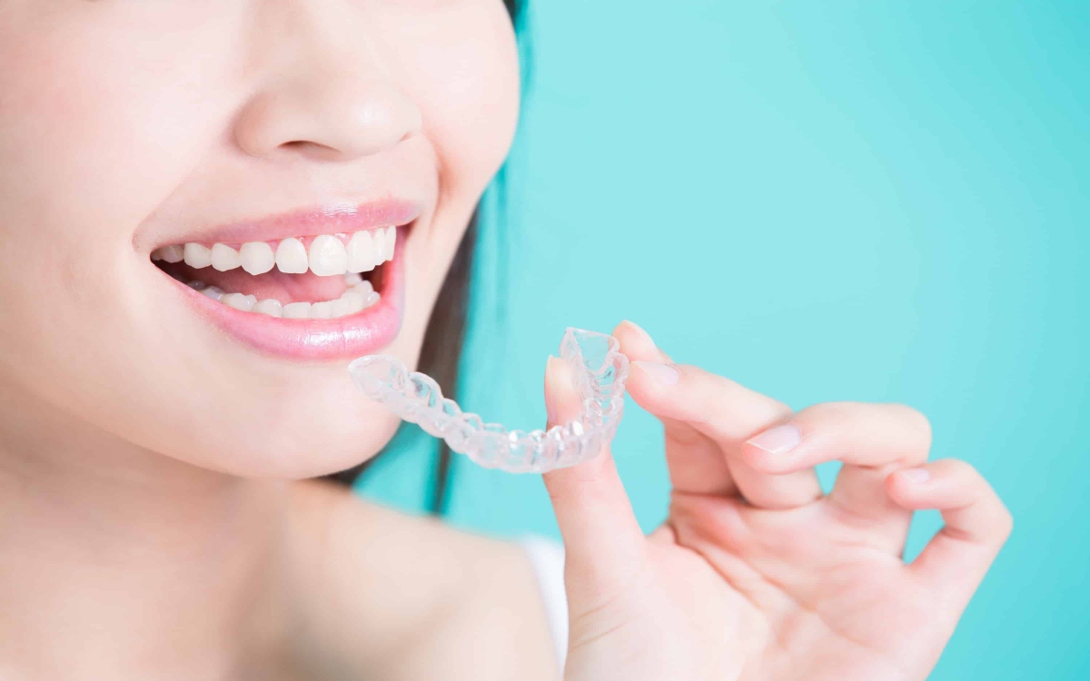 Aligners Treatment Planning In USA Is Becoming A Necessity