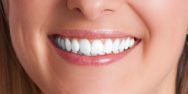 Caring for Your Dental Implants: Tips for Long-Term Success