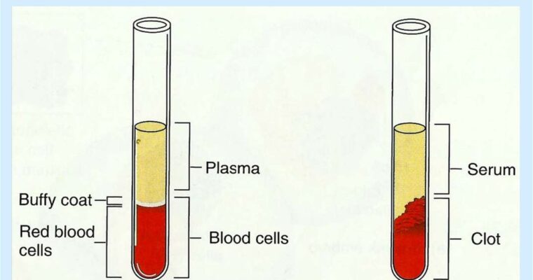 Serum Vs Plasma